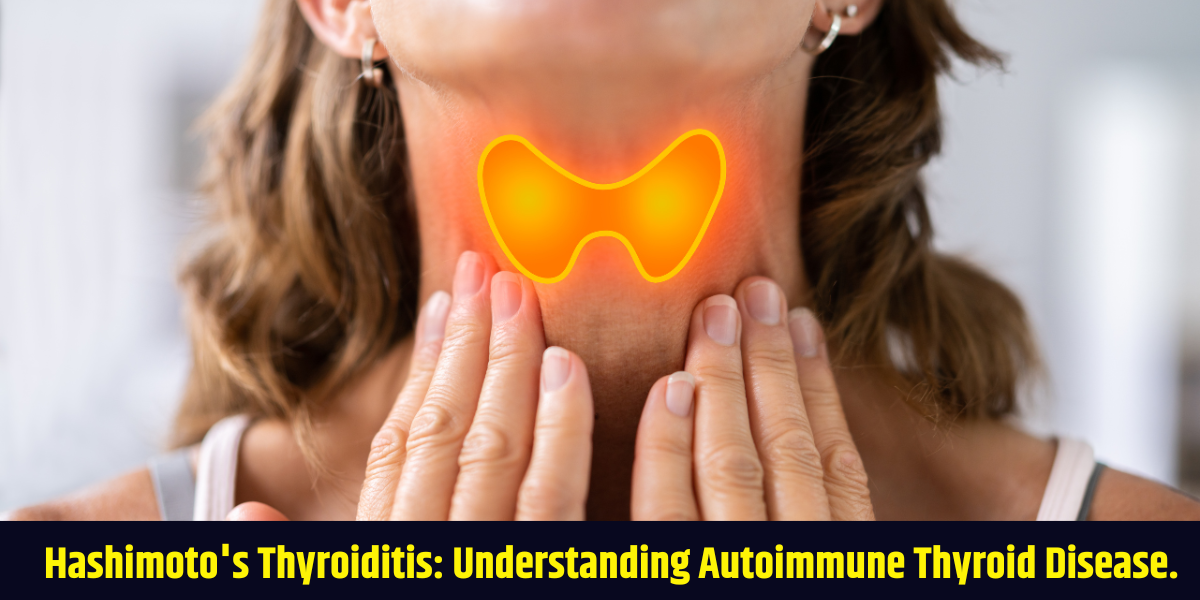 Hashimoto’s Thyroiditis Understanding Autoimmune Thyroid Disease. Hashimoto's Thyroiditis: Understanding Autoimmune Thyroid Disease.