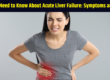 What You Need to Know About Acute Liver Failure: Symptoms and Causes.